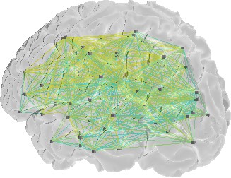 Human brain